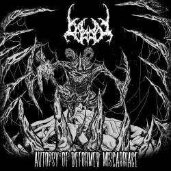 Bigot : Autopsy of Deformed Miscarriage